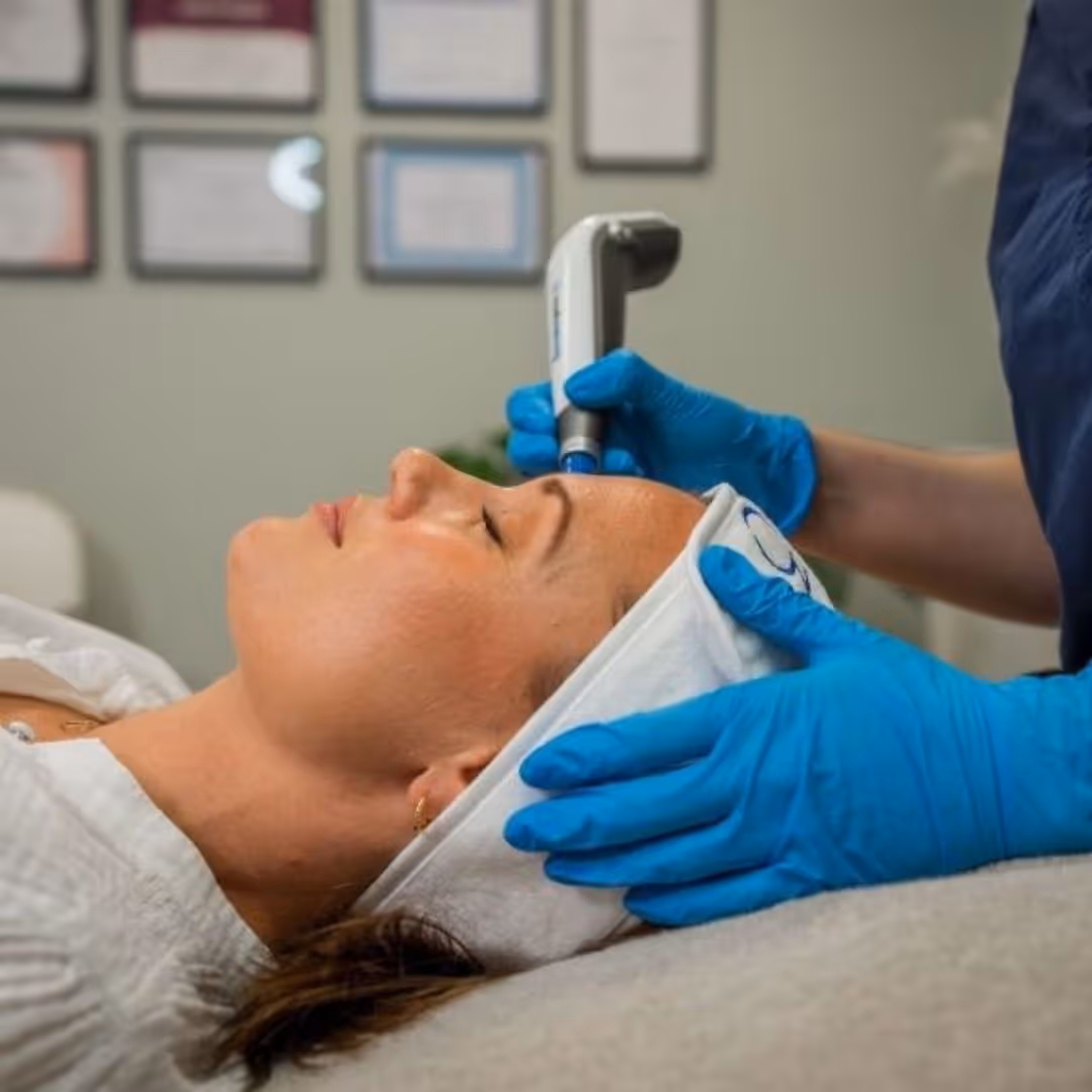 Hudbehandling med Dermapen